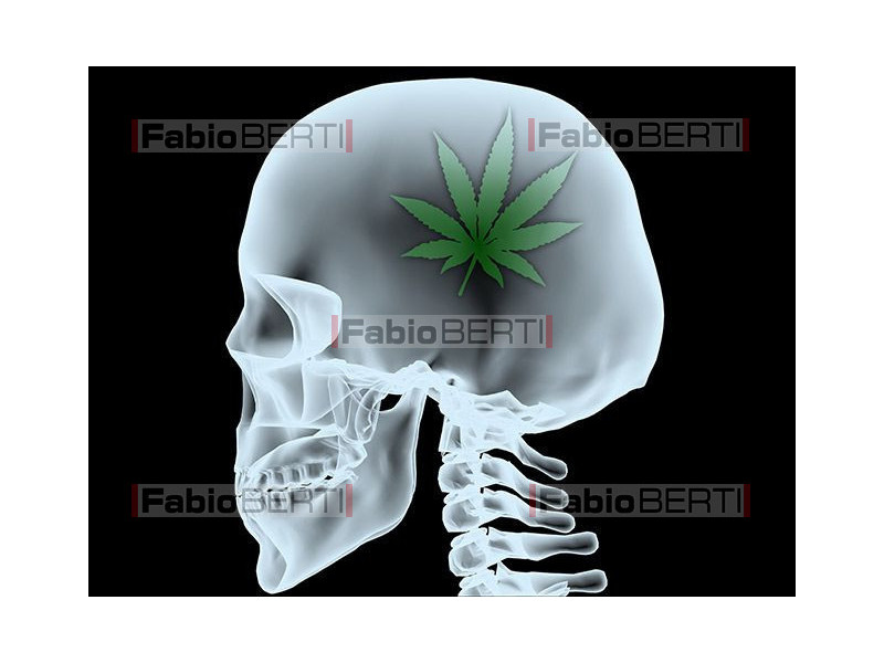raggi x testa marijuana