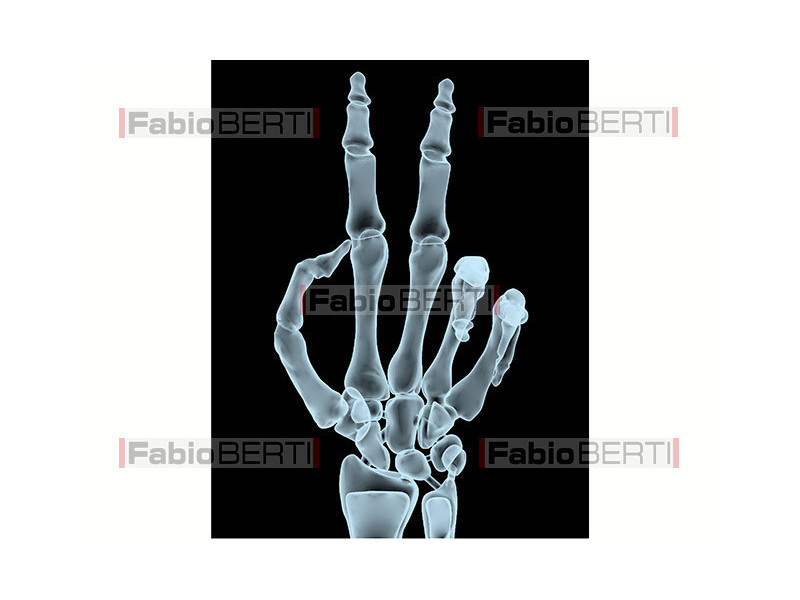victory gesture X-Ray