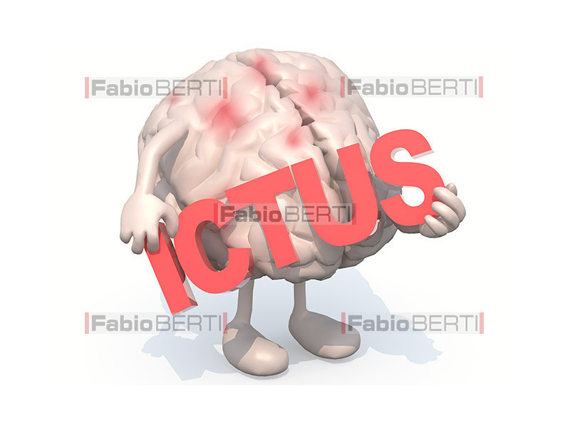 brain ictus